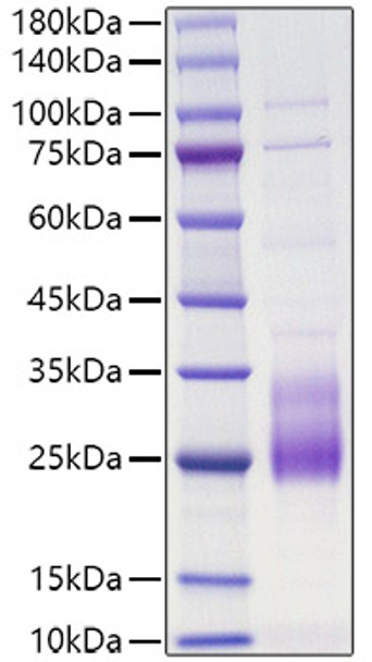 Recombinant Human IL-31 Protein (RPCB1161)