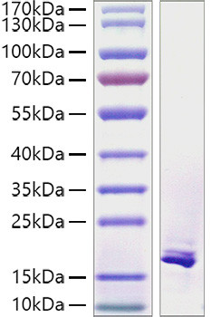 Recombinant Human TNFSF12/TWEAK Protein (RPCB1182)