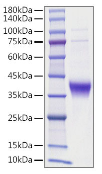 Recombinant human Ephrin-A3/EFNA3 Protein (RPCB1185)