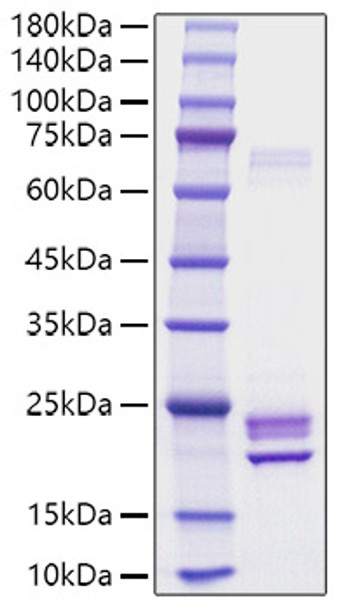 Recombinant Rat IL-1 alpha Protein (RPCB1186)