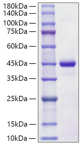 Recombinant Human S100-A7 Protein (RPCB1190)