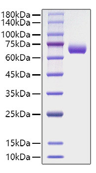 Recombinant Human IFN-gamma R2 Protein (RPCB1198)