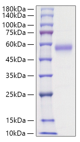 Recombinant Human IL-5RA/CD125 Protein (RPCB1201)