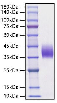 Recombinant Mouse B7-DC/PD-L2/CD273 Protein (RPCB1202)