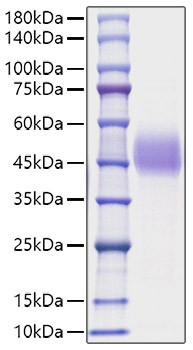 Recombinant Mouse TFPI Protein (RPCB1203)