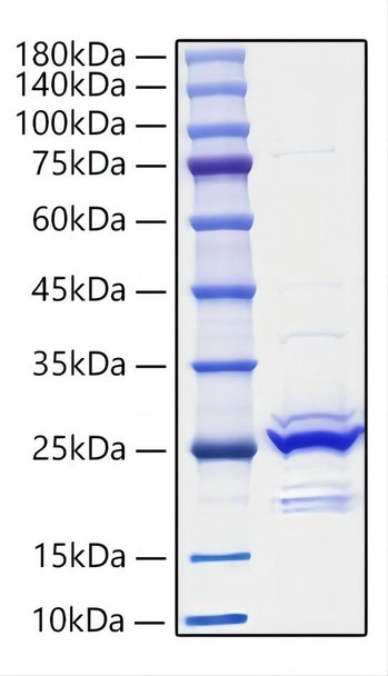 Recombinant Mouse FGF-9 Protein (RPCB1222)