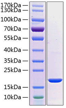 Recombinant Human PRL-2 Protein (RPCB1261)