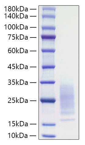 Recombinant Mouse IL-31 Protein (RPCB1276)
