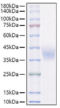 Recombinant Rat IL-4R alpha/CD124 Protein (RPCB1278)
