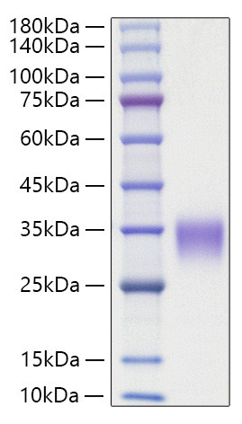 Recombinant Rat Oncostatin-M/OSM Protein (RPCB1280)