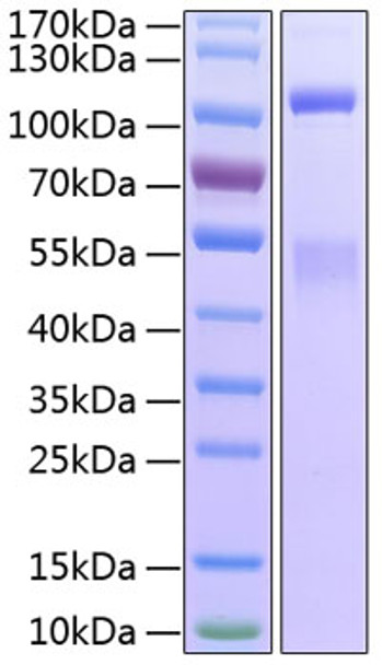 Recombinant Human IGF1R/CD221 Protein (RPCB1290)