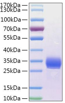 Recombinant Human Angiopoietin-like 4/ANGPTL4(166-406) Protein (RPCB1291)