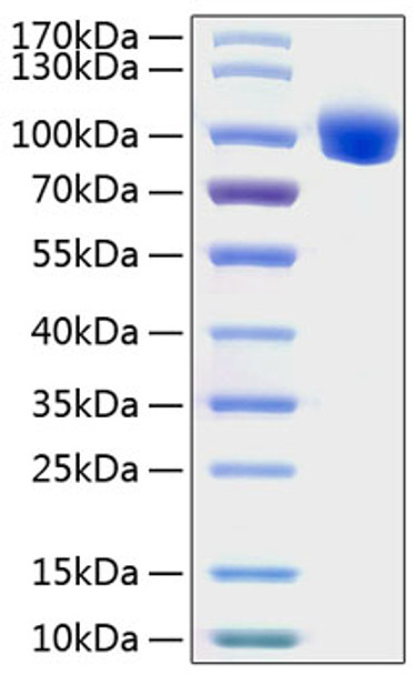Recombinant Human ROR1 Protein (RPCB1303)