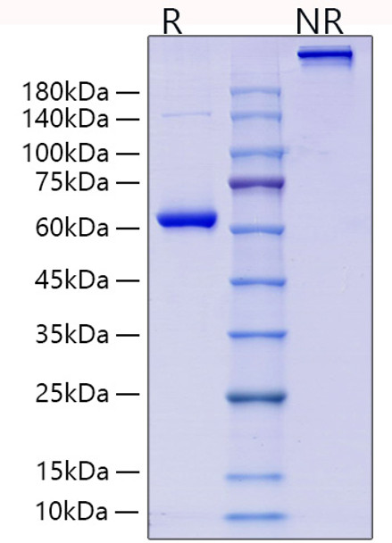 Recombinant Human Collagen II alpha 1/COL2A1 Protein (RPCB1306)