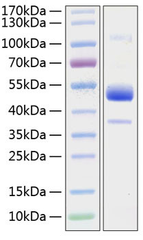 Recombinant Human BMPR-1B/ALK-6/CDw293 Protein (RPCB1317)