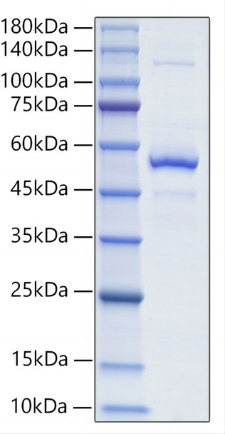 Recombinant Mouse TNFSF13B/BAFF/CD257 Protein (RPCB1329)