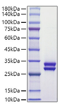 Recombinant Human Prolactin/PRL Protein (RPCB1339)