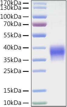 Recombinant Mouse B7-H5/Gi24/VISTA Protein (RPCB1364)