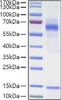 Recombinant Human Vitronectin/V75/VTN Protein (RPCB1404)