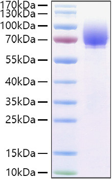 Recombinant Human Microtubule-associated protein tau/MAPT Protein (RPCB1405)