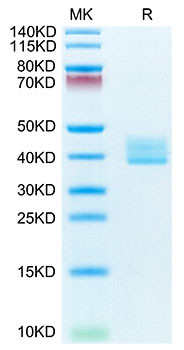 Recombinant Mouse TNFRSF17/BCMA/CD269 Protein (RPCB1406)