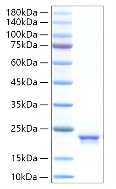 Recombinant Human IFN-alpha 21 Protein (RPCB1412)