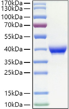 Recombinant Human Fc epsilon RII/CD23 Protein (RPCB1423)
