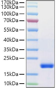 Recombinant Human VEGF-D/FIGF Protein (RPCB1426)