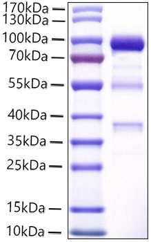 Recombinant Human Carboxypeptidase E/CPE Protein (RPCB1438)