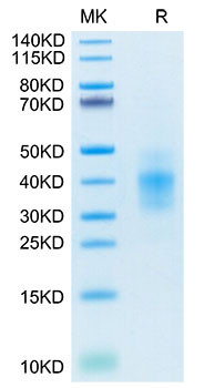 Recombinant Human NKG2A&KLRD1/CD159a&CD94 Protein (RPCB1446)