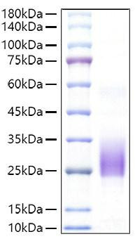 Recombinant Mouse BY55/CD160 Protein (RPCB1460)