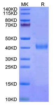 Recombinant Cynomolgus IL-2RB/CD122 Protein (RPCB1481)