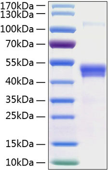 Recombinant Human TSG-14/PTX3 Protein (RPCB1507)