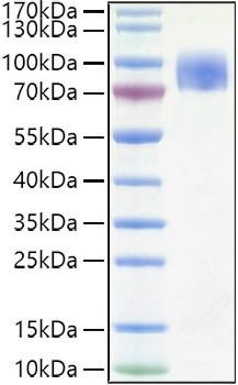 Recombinant Human CD200R1 Protein (RPCB1542)