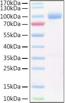 Recombinant Human IL-6RA/CD126 Protein (RPCB1547)