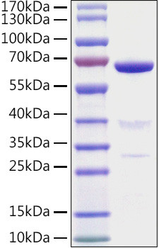 Recombinant Mouse 5'-Nucleotidase/NT5E/CD73 Protein (RPCB1558)