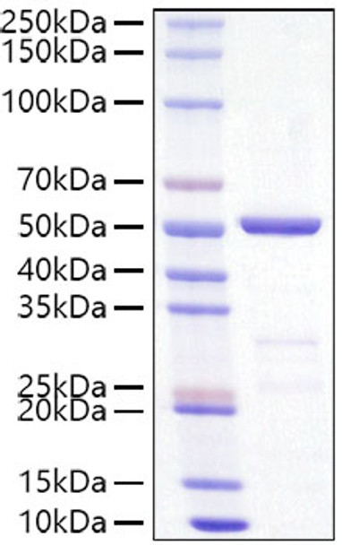 Recombinant SARS-CoV-2 Nucleocapsid (B.1.617.2/Delta) Protein (RPCB1585)