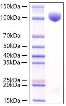 Recombinant Mouse c-kit/CD117 Protein (RPCB1586)