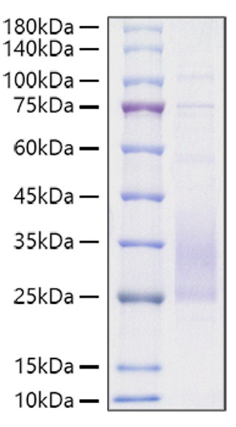 Recombinant Mouse TREM2 Protein (RPCB1621)