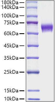 Recombinant Mouse TNFRSF9/4-1BB/CD137 Protein (RPCB1633)