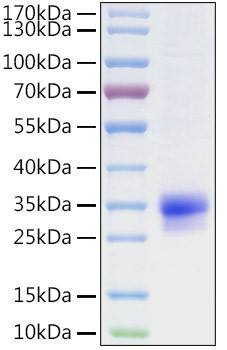 Recombinant Human CFHR2 Protein (RPCB1701)