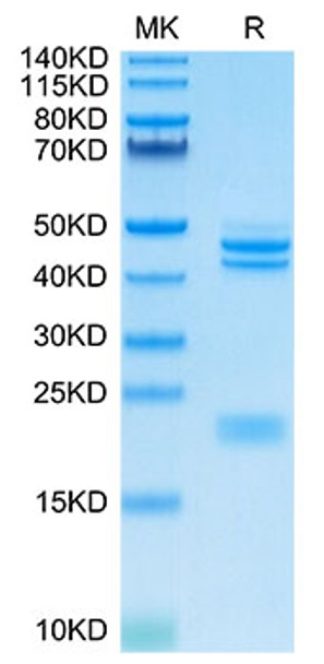 Recombinant Cynomolgus IL-23A&Mouse IL-12B Protein (RPCB1708)