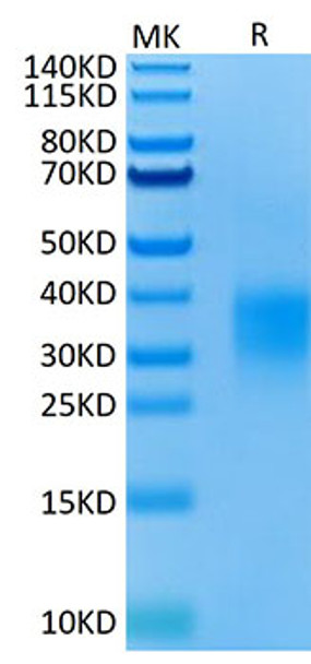 Recombinant Mouse TNFRSF18/GITR/CD357 Protein (RPCB1734)