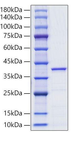 Recombinant Human Lactate Dehydrogenase A/LDHA Protein (RPCB1773)