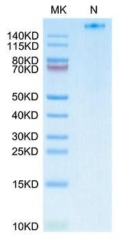 Recombinant Human NY-ESO-1(HLA-A*02:01) Tetramer Protein (RPCB1785)