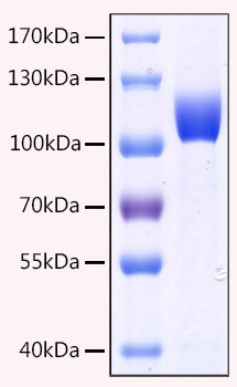 Recombinant Human MME/CD10 Protein (RPCB1792)
