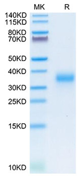 Recombinant Human DHLAG/CD74 Protein (RPCB1805)