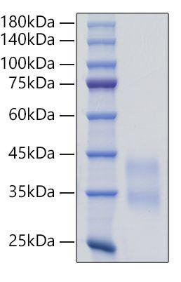Recombinant Mouse Sclerostin/SOST Protein (RPCB1809)