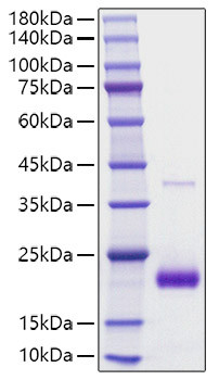 Recombinant human SECTM1 Protein (RPCB1812)