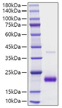 Recombinant human SECTM1 Protein (RPCB1812)